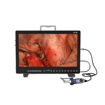 2k Преносимо ендоскопско медицинско оборудване за изображения HD ендоскоп ENT/Laparoscopy/Hysteroscopy/Urology